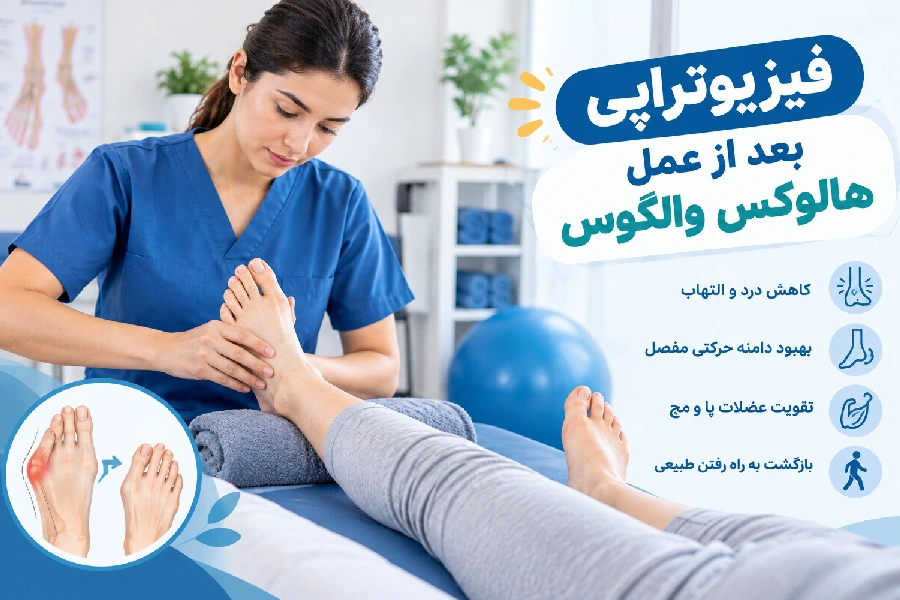فیزیوتراپی بعد از عمل هالوکس والگوس